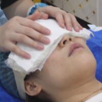 去眼袋手术多少钱？做了激光去眼袋价格5800元，恢复很好