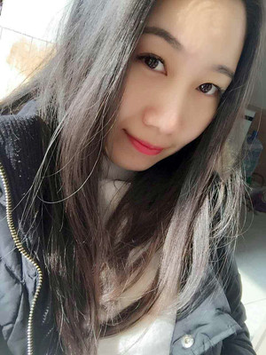 自体脂肪丰面颊，见证我蝶变的过程