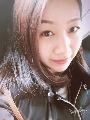 自体脂肪丰面颊，见证我蝶变的过程