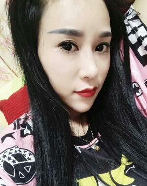 牛永敢做的隆鼻失败修复，对比很明X哦~