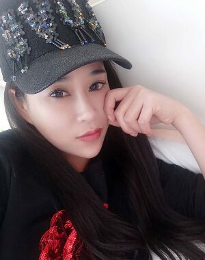 牛永敢做的隆鼻失败修复，对比很明X哦~