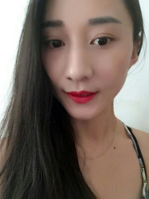 激光祛斑前后对比图，雀斑全都没啦