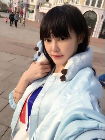 我的膨体隆鼻恢复的那些日子 内有果对比图