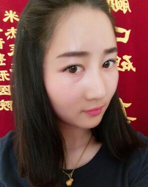 下图是自体脂肪填充后