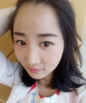 自体脂肪填充太阳穴+额头第十天