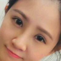 在昆明做了眼睛和鼻子整形，虽然花费了16000元，但人美了就值！