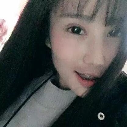 牙齿矫正的真实过程，现在我终于可以露出牙齿放声大笑了