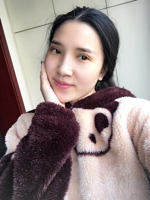 开眼角+割双眼皮手术前后过程图分享