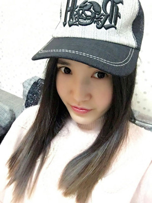 开眼角+割双眼皮手术前后过程图分享