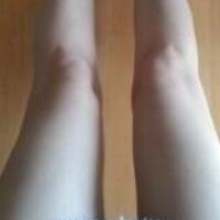 水动力吸脂减肥瘦大腿真实经历，抽脂后对比照片分享