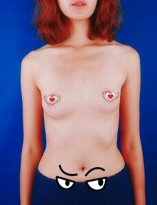 曼托假体隆胸前正面图片