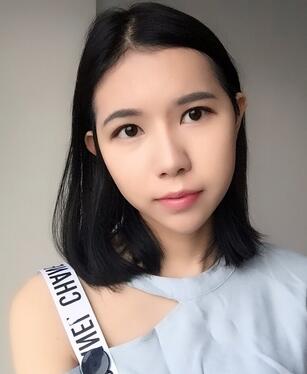 自体脂肪填充恢复日志 自体脂肪填充太阳穴+额头