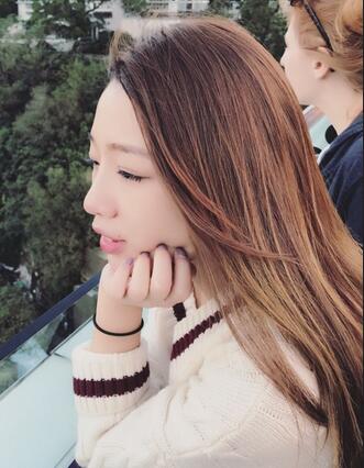 硅胶隆鼻恢复日记 硅胶隆鼻+鼻小柱延长+垫鼻尖