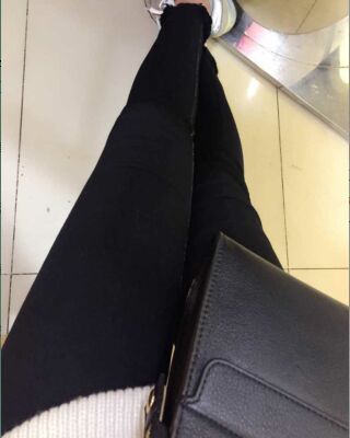 大腿抽脂的过程照片，瘦了一大圈呢