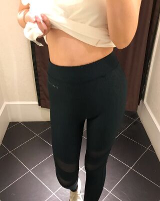 腰腹吸脂减肥真实案例，果好不反弹