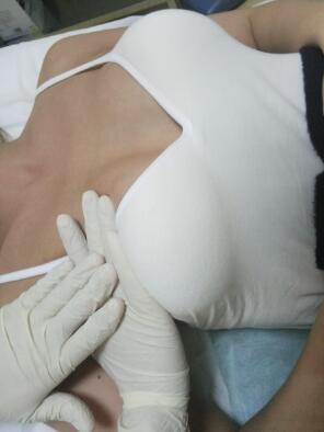 术后两周，去医院，医生教了按摩方法