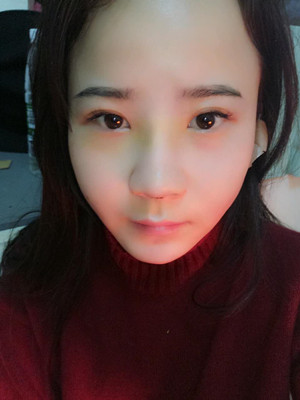 隆鼻整形前后对比变化真的不要太大哦