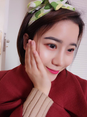 隆鼻整形前后对比变化真的不要太大哦