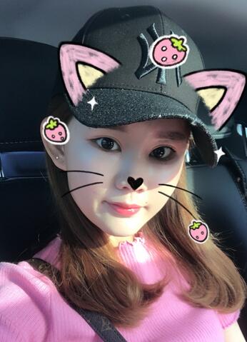 详细部脂肪填充果图 术后恢复分享