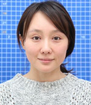 面部埋埋蛋白线.提升手术前照片