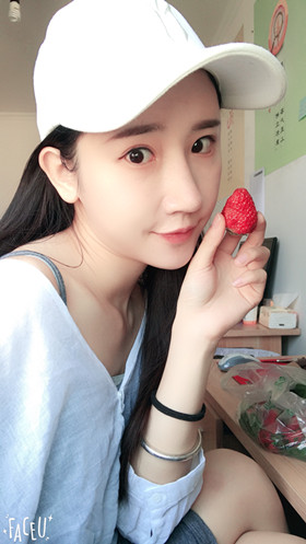 56000元做的自体脂肪填充苹果肌+太阳穴，大家来看看果怎么样