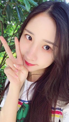 56000元做的自体脂肪填充苹果肌+太阳穴，大家来看看果怎么样