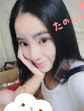 隆鼻整形2个月恢复日记 硅胶隆鼻+鼻翼缩小