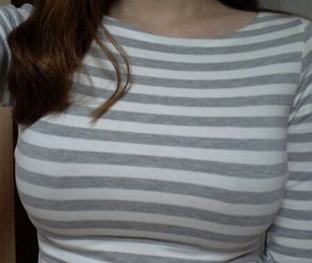 假体隆胸多久能恢复，亲测两个月吧