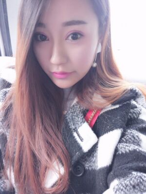 双眼皮失败修复手术恢复前后对比图