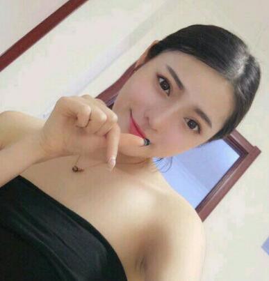 假体隆鼻15天后恢复图，隆鼻果自然