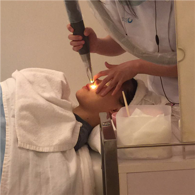 杭州格莱美徐云喜激光去黄褐斑案例