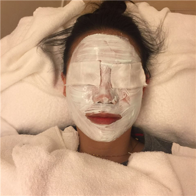 杭州格莱美徐云喜激光去黄褐斑案例