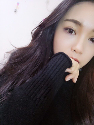 你们看看我做的欧式大双眼皮怎么样