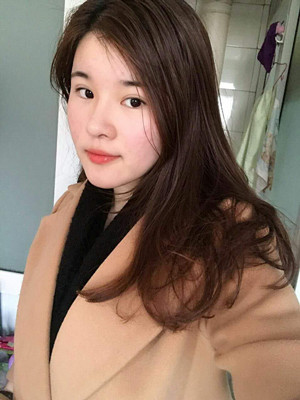 做了详细部脂肪填充+双眼皮+假体隆鼻，来看看果如何