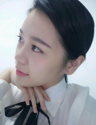 隆鼻拆线后鼻子图片 硅胶隆鼻+鼻翼缩小恢复经历