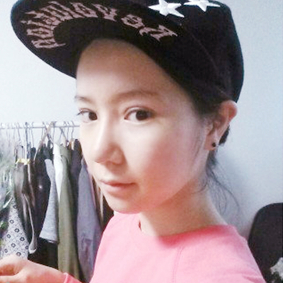 武汉五洲美莱刘杨切开双眼皮案例