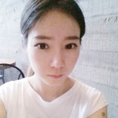 武汉五洲美莱刘杨切开双眼皮案例