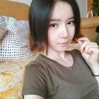 武汉五洲美莱刘杨切开双眼皮案例