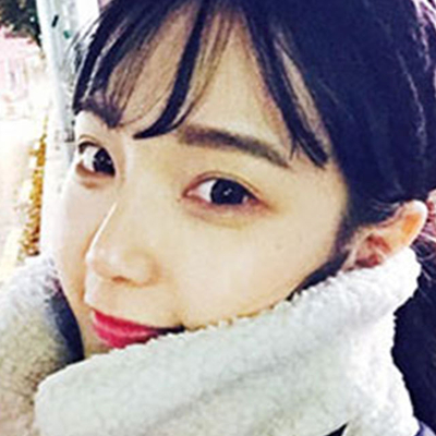 南京华美沈正宇硅胶假体隆鼻案例