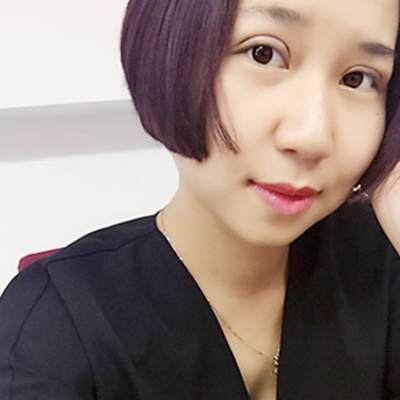 南京华美曹海峰双眼皮案例