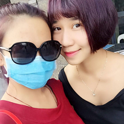 南京华美曹海峰双眼皮案例