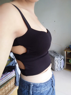 做完自体脂肪丰胸手术3个月啦!来看看前后对比照片哦