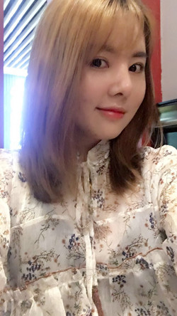 歪鼻矫正+假体隆鼻前后手术过程图片分享