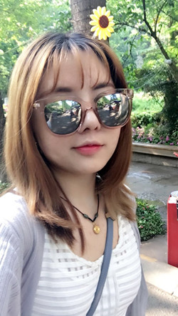 歪鼻矫正+假体隆鼻前后手术过程图片分享