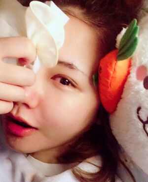 韩式定点双眼皮前后对比图，双眼有神多了