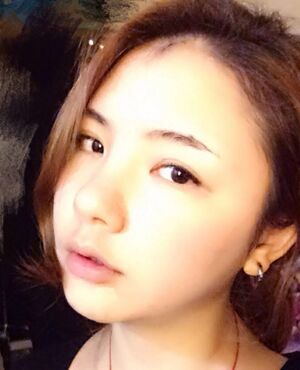 韩式定点双眼皮前后对比图，双眼有神多了