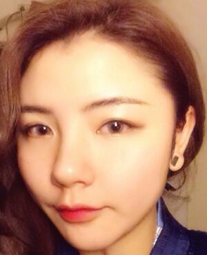 韩式定点双眼皮前后对比图，双眼有神多了