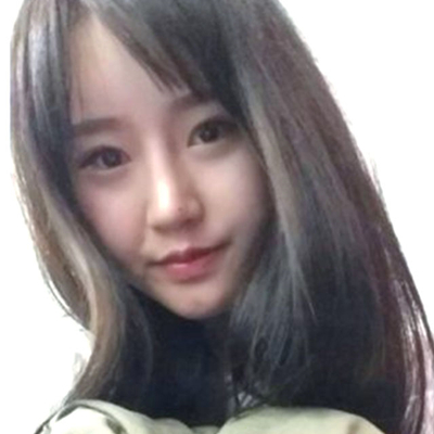 苏州紫馨孙影玻尿酸隆鼻案例