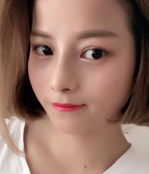 鼻部整形案例和隆鼻前后照片分享