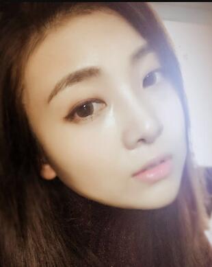 鼻子整形过程恢复图片，真实案例分享